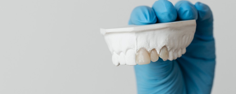 Veneers in Redcliffe and Newport