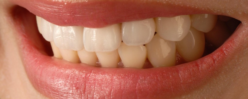 Cosmetic Dentistry in Redcliffe: Transform Your Smile with Veneers and More